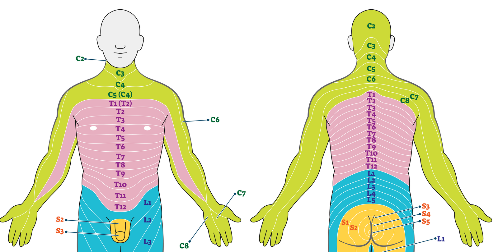 dermatome map showing the C5 and C6 nerve root distribution over the shoulder outer arm and hand